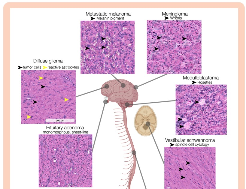 hou2026intelligent_histology.png